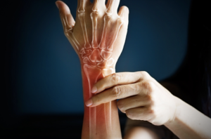 Dry Needling 101